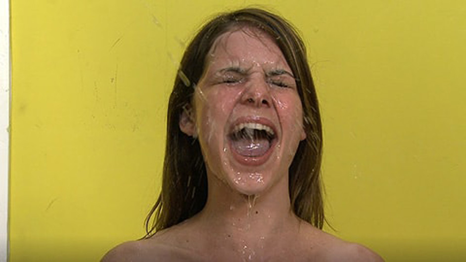 Facial Abuse Michelle Peters